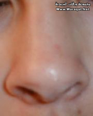 bntpal_1425126680_89