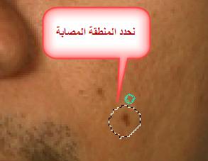  bntpal_1429162837_26