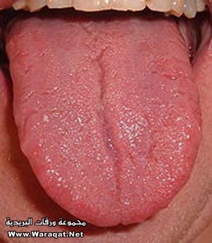 bntpal_1431458638_61