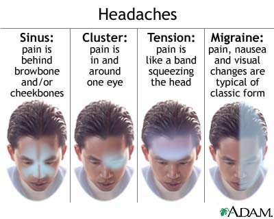 Migraine Headaches bntpal_1438757923_25