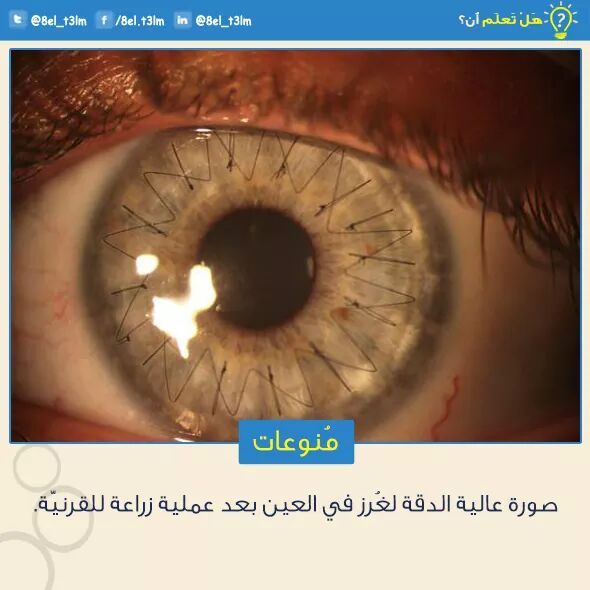 .... bntpal_1438775810_22