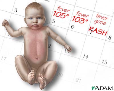Roseola bntpal_1439194289_24