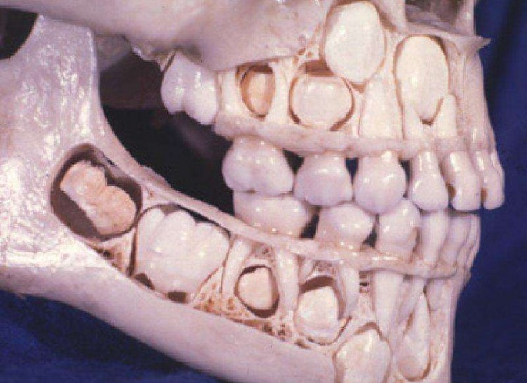 bntpal_1440410128_69