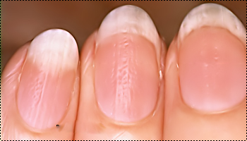 bntpal_1460913221_25