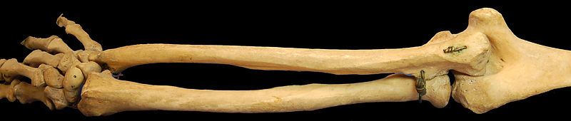  bntpal_1493412967_47